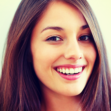 Veneers